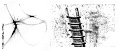 Vector Anatomical of a human spine and brain with branching vessels.