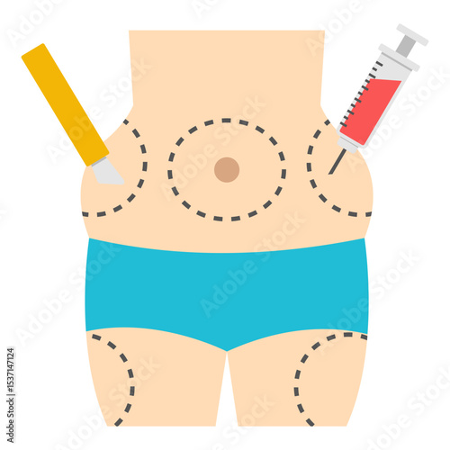 Liposuction Surgery Procedure Medical Illustration Vector Graphic