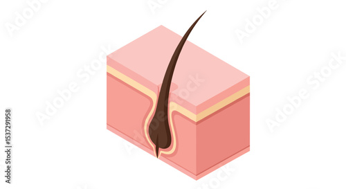 Isometric Cross Section of Human Skin Layers Showing Hair Follicle and Texture