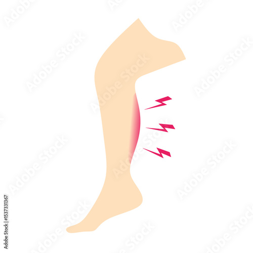 Vector illustration of leg calf pain showing muscle cramp or injury with lightning pain symbols. Medical, therapy, sports injury, and healthcare concept.
