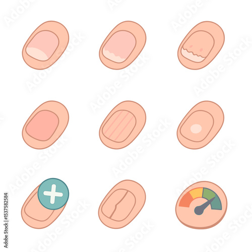Nail Health Icon Set. Isometric Flat icon set of nail health indicators: healthy nail, brittle nail, dry cuticle, ingrown nail,