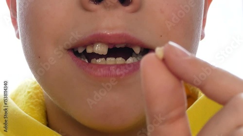 The child opens his mouth and shows the freshly pulled out milk tooth. Change of teeth in children. Pediatric dentistry and dental care in children. photo