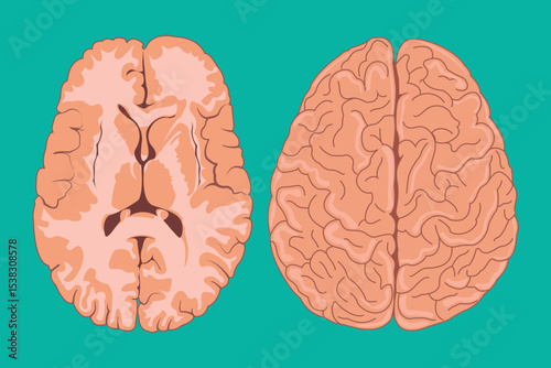 Detailed vector of human brain seen from superior and inferior perspectives.