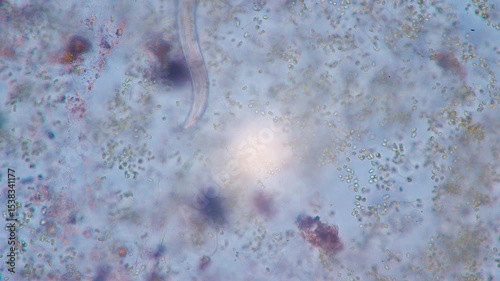 The amazing world of microbiology. Different bacteria, microbes and single-celled microorganisms are visible through a microscope. High-quality video.