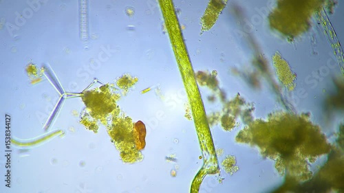 The amazing world of microbiology. Different bacteria, microbes and single-celled microorganisms are visible through a microscope. High-quality video.