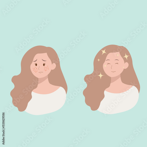 Acne treatment, skin, face, before, after, Asian, scars, happy, sad, women, girl, isolated, adult, formation, closeup, teenager, care, lady, young,pimples, blackheads, and blemishes skin conditions