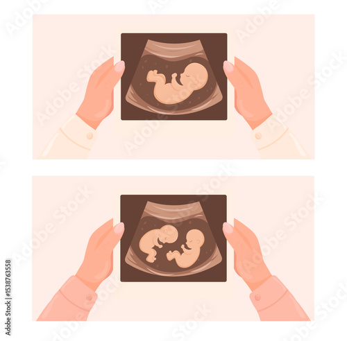 Vector cartoon image of ultrasound scan with baby. Pregnancy management concept. Element for your design