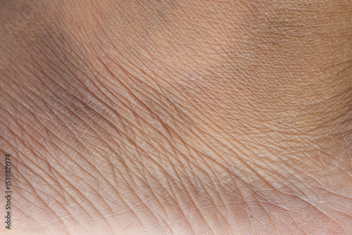 Close-up of the wrinkled texture of human skin,Texture of human skin. Dried skin spores. Extreme close up macro shot. 