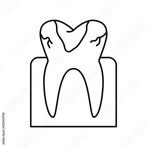 Dental caries