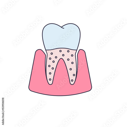 Gum disease