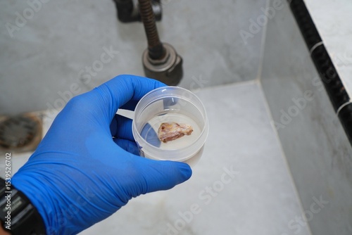 A doctor's blue-gloved hand holds a container containing a sample of tumor tissue for histological examination. A jar contains a biopsy of mammary tumor