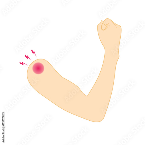 Vector illustration of human arm with shoulder pain symbolized by red inflammation and pain marks. Perfect for medical, orthopedic, physiotherapy, and health-related content.