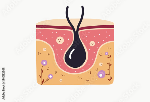 Whimsical cartoon illustration of a clogged pore or blackhead in a skin cross-section, a friendly and educational graphic for dermatology and skincare.
