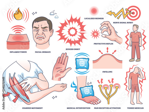 Acute pain worksheet concept shows a person grimacing, inflamed tissue, and pain signals to illustrate pain response. Outline style collection