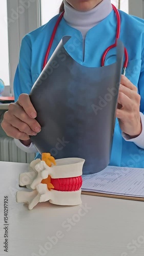 Understanding spinal health through educational models and patient analysis in a medical office setting