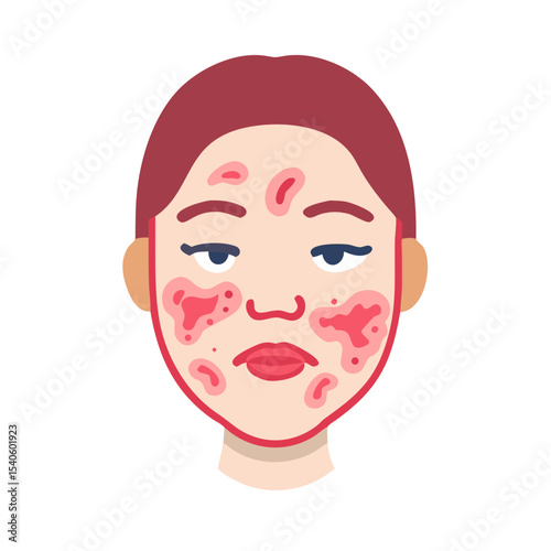 Flaky Skin Patch Illustration 