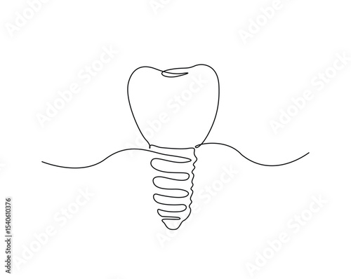 Dental implant structure outline illustration. Continuous line drawing of dental implant.