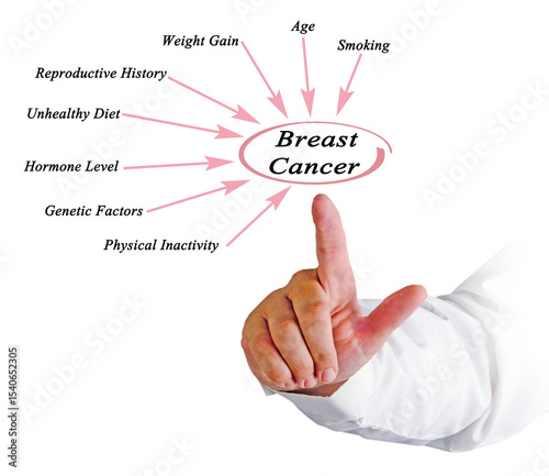 factors Influencing Risk of Breast Cancer