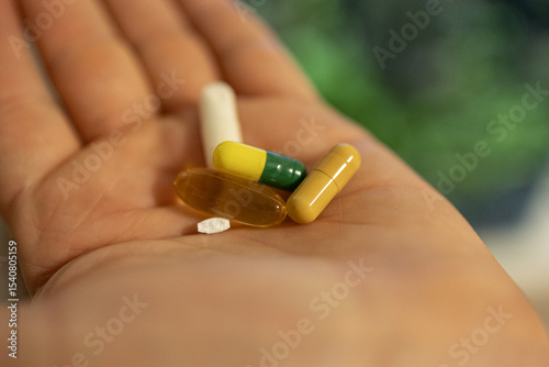 Open hand displaying assortment of colorful pills and capsules for healthcare concept