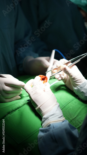 Doctors Conducting Operation in Hospital Surgery Room Close Up View of Surgeon Hands in Cinematic Light