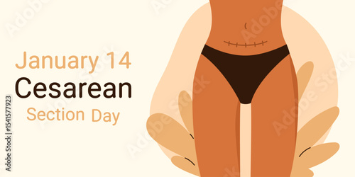 January 14. Cesarean Section Day. Cesarean scar. Stitches after caesarean section on female belly. C-section, surgical delivery operation concept. Isolated vector illustration in cartoon style

