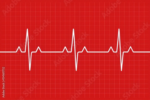 Accurate digital cardiogram trace on red grid background featuring white heartbeat lines, representing health data analysis and professional medical diagnostics