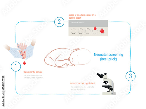 Neonatal screening showing heel prick blood sampling and analysis