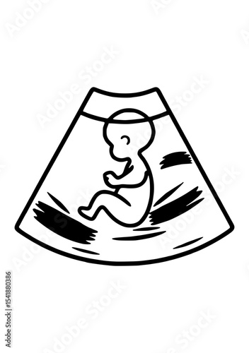 An illustration of a fetus in the womb, depicted in a simple ultrasound scan style.