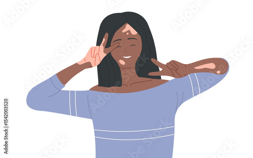 Girl with skin problems vitiligo vector illustration. Cartoon young happy woman character with depigmentation patches smiling, beautiful body positive model waving. International vitiligo day concept