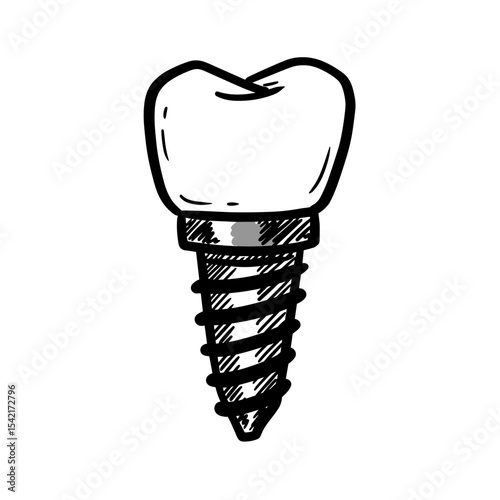 Tooth implant icon with screw in sketch style for dental restoration concept