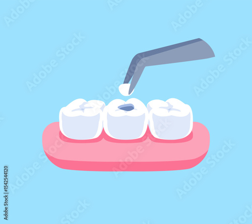 Dental filling with dental tweezer illustration vector design. Dental care concept.