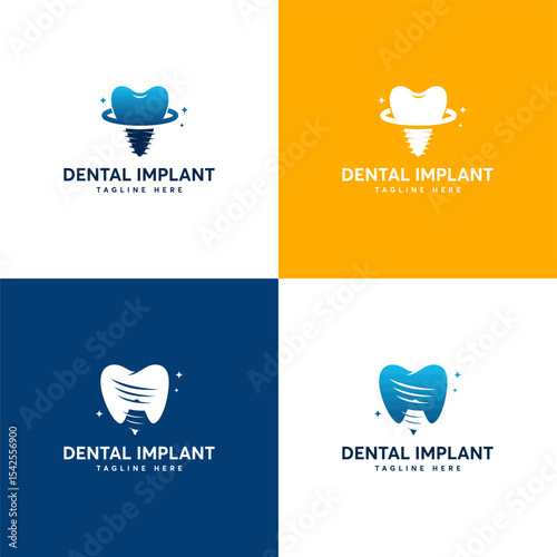 Four dental implant  variations.