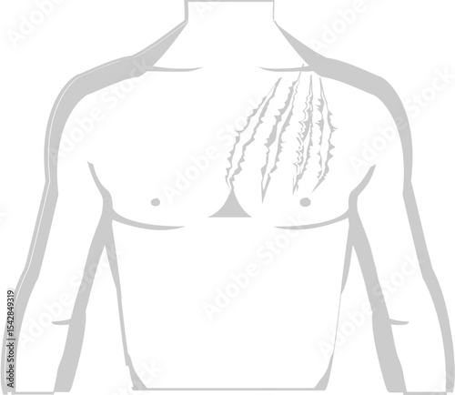 Male torso illustration showing claw marks on chest