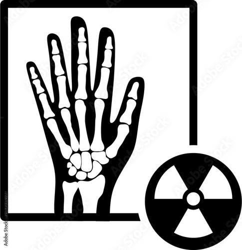 X ray