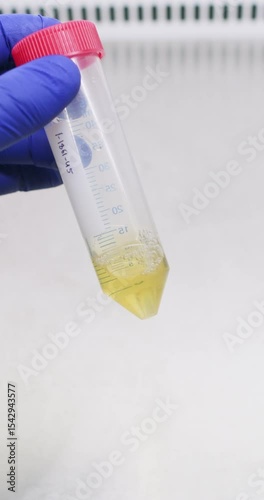 Laboratory assistant studies consistency of yellow fluid in tube. Lab worker in protective rubber gloves observes reagent to detect bubbles and particles vertical shot