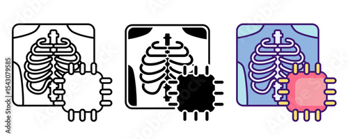 X ray analysis