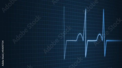 Abstract ECG Animation with Beating Pulse Line for Scientific and Medical Explainer, Electrocardiogram Line Graph on Grid Background