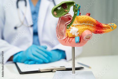 Schilderij op canvas Pancreatitis, pancreatic cancer, Asian doctor with pancreas, gallbladder and bile duct human anatomy model at hospital