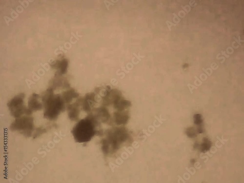 Rotifer in the water on a microscope glass