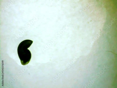 Leech on  a microscope glass