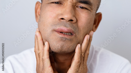 Man has facial swelling due to an allergic reaction to triggers such as insect bites, food