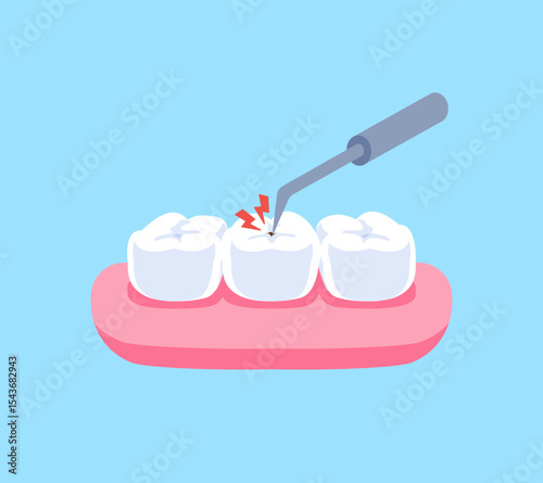 Sickle scaler with enamel caries illustration vector design. Dental care concept.