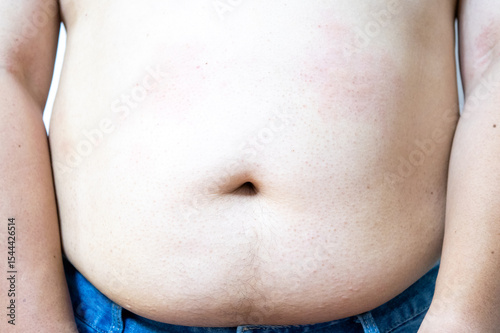 Obesity man body, fat male belly,close up on white background.highlighting issues of obesity or body weight.