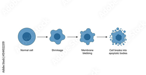 Apoptosis. Programmed cell death. Aging process in cells. Stages of apoptosis, normal cell, shrinkage, membrane blebbing, cell breaks into apoptotic bodies and phagocytosis. Vector illustration.