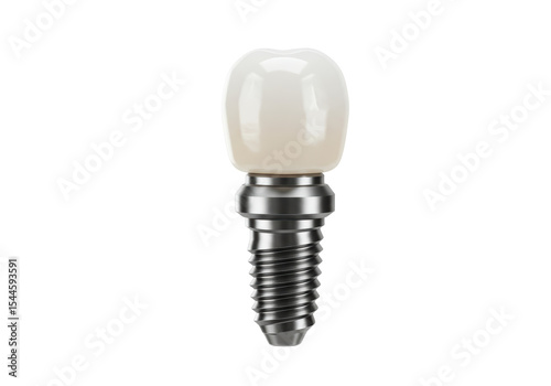 Isolated Single Dental Implant Tooth Prosthetic Illustration