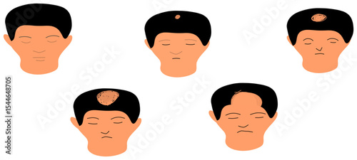 hair loses 5 stage vector men