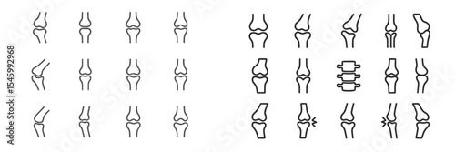 Variations of knee joint illustrations showing different orientations and conditions in a medical diagram for educational purposes