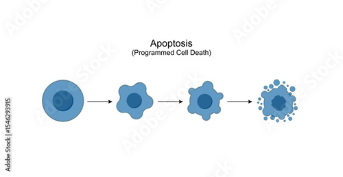Apoptosis. Programmed cell death. Aging process in cells. Stages of apoptosis, normal cell, shrinkage, membrane blebbing, cell breaks into apoptotic bodies and phagocytosis. Vector illustration.