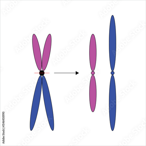 Chromosomal abnormalities Isochromosome