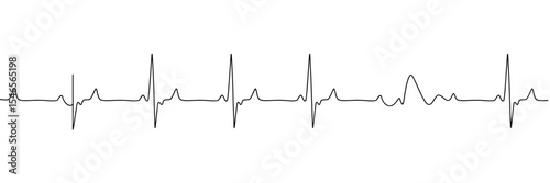 Heartbeat Electrocardiogram ECG Line on White Background for Medical Illustration